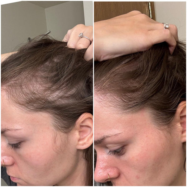 Customer results photo