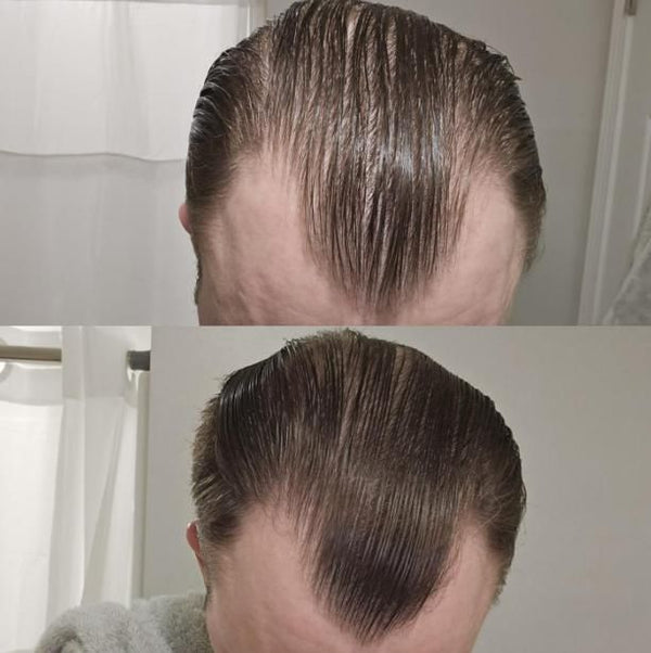 Customer results photo