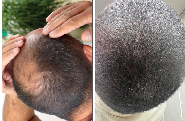 Customer results photo